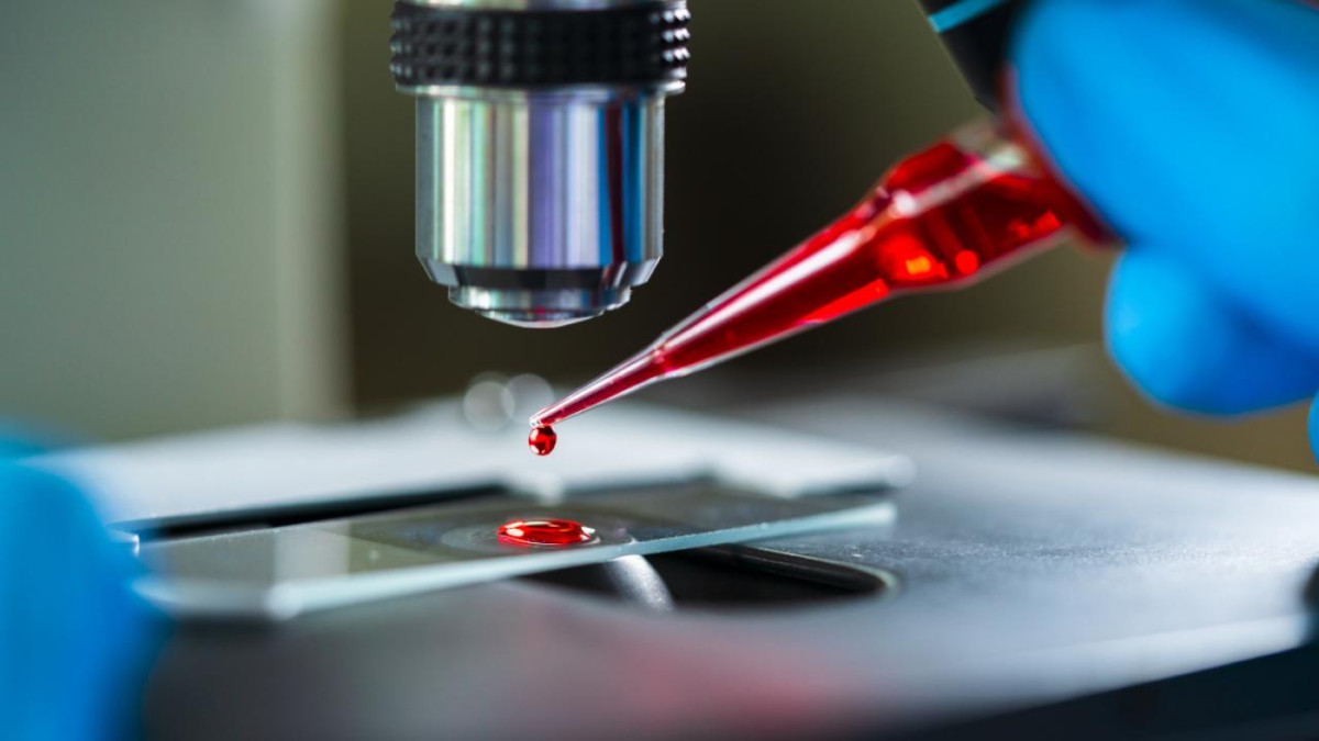 Gen Testleri Ger&ccedil;eği Ortaya &Ccedil;ıkardı